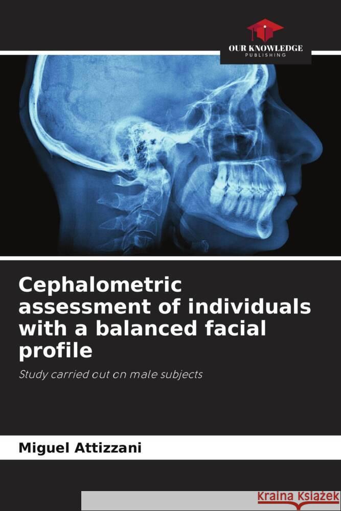 Cephalometric assessment of individuals with a balanced facial profile Attizzani, Miguel 9786208630546 Our Knowledge Publishing