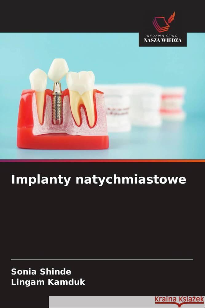Implanty natychmiastowe SHINDE, SONIA, KAMDUK, LINGAM 9786208631505 Wydawnictwo Nasza Wiedza