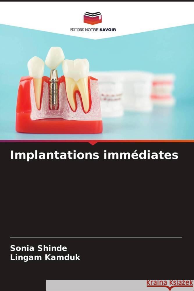Implantations immédiates SHINDE, SONIA, KAMDUK, LINGAM 9786208631512 Editions Notre Savoir