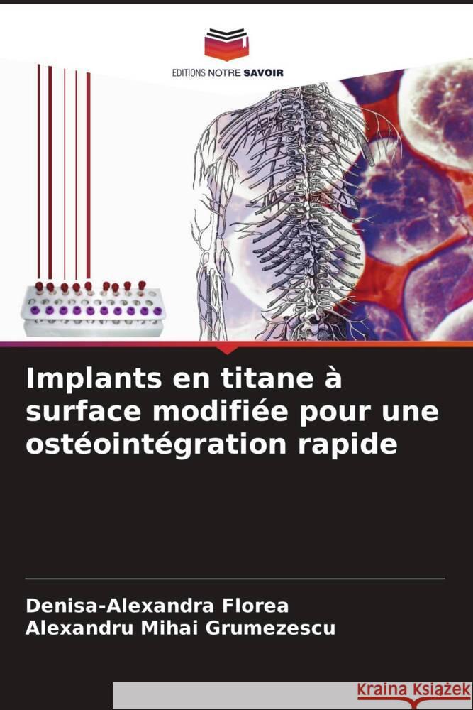 Implants en titane à surface modifiée pour une ostéointégration rapide Florea, Denisa-Alexandra, Grumezescu, Alexandru Mihai 9786208640125 Editions Notre Savoir
