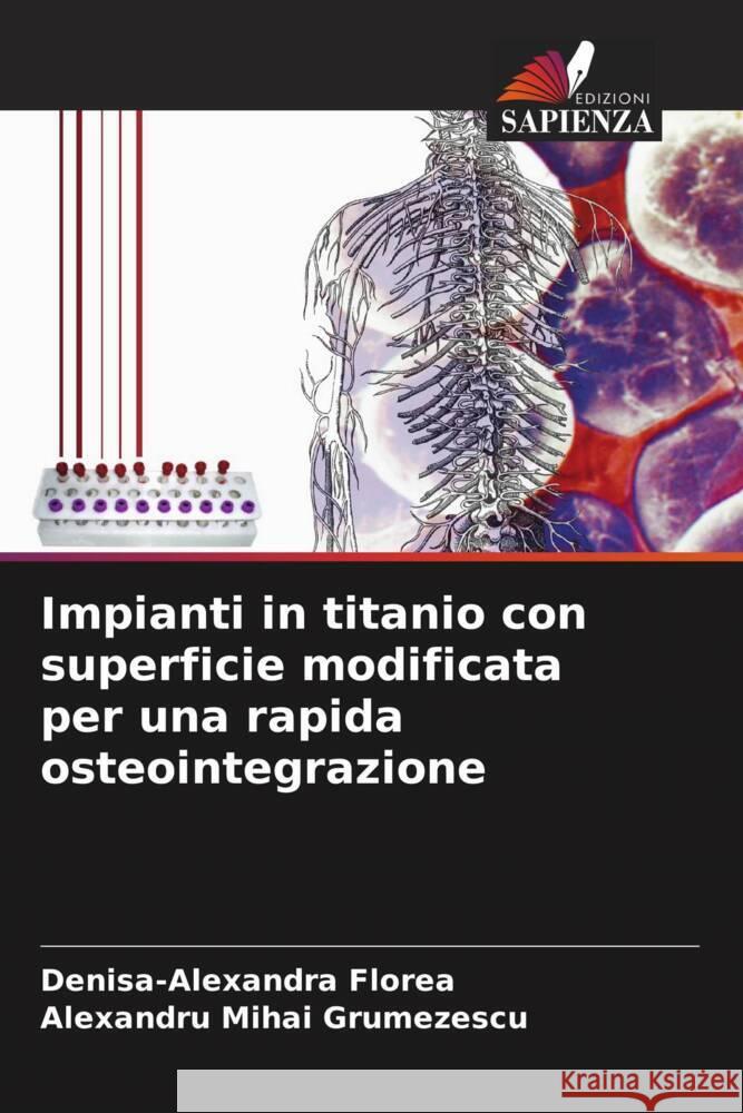 Impianti in titanio con superficie modificata per una rapida osteointegrazione Florea, Denisa-Alexandra, Grumezescu, Alexandru Mihai 9786208640132 Edizioni Sapienza