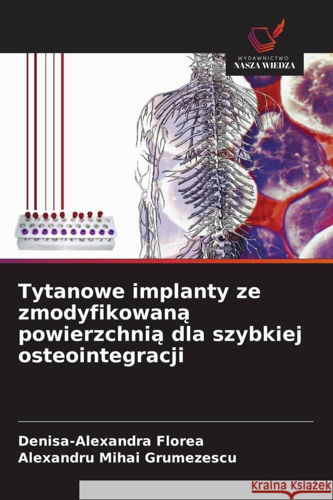 Tytanowe implanty ze zmodyfikowana powierzchnia dla szybkiej osteointegracji Florea, Denisa-Alexandra, Grumezescu, Alexandru Mihai 9786208640149 Wydawnictwo Nasza Wiedza