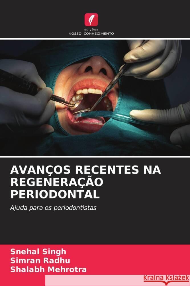 AVANÇOS RECENTES NA REGENERAÇÃO PERIODONTAL Singh, Snehal, Radhu, Simran, Mehrotra, Shalabh 9786208641627