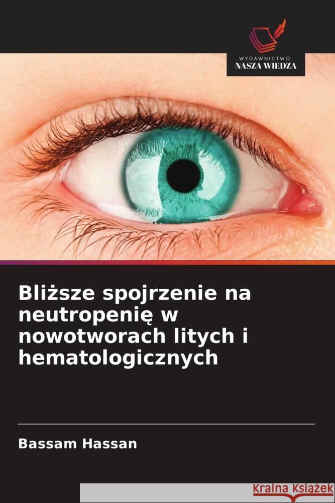 Blizsze spojrzenie na neutropenie w nowotworach litych i hematologicznych Hassan, Bassam 9786208645403