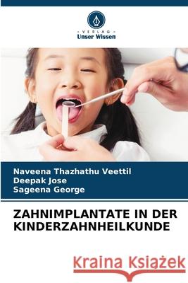 ZAHNIMPLANTATE IN DER KINDERZAHNHEILKUNDE Thazhathu Veettil, Naveena, Jose, Deepak, George, Sageena 9786208649715