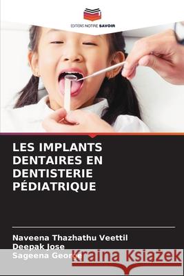 LES IMPLANTS DENTAIRES EN DENTISTERIE PÉDIATRIQUE Thazhathu Veettil, Naveena, Jose, Deepak, George, Sageena 9786208649722