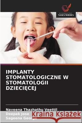 IMPLANTY STOMATOLOGICZNE W STOMATOLOGII DZIECI CEJ Thazhathu Veettil, Naveena, Jose, Deepak, George, Sageena 9786208649753
