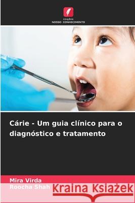 Cárie - Um guia clínico para o diagnóstico e tratamento Virda, Mira, Shah, Roocha 9786208650896