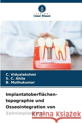 Implantatoberflächen- topographie und Osseointegration von Zahnimplantaten Vidyalakshmi, C., Ahila, S. C., Muthukumar, B. 9786208651008