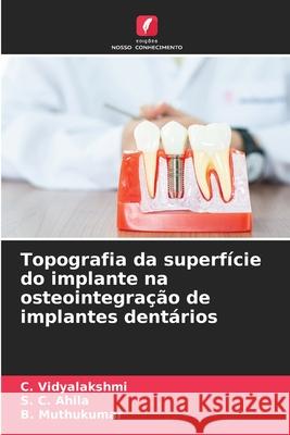 Topografia da superfície do implante na osteointegração de implantes dentários Vidyalakshmi, C., Ahila, S. C., Muthukumar, B. 9786208651053