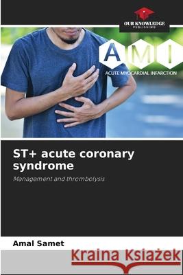 ST+ acute coronary syndrome Samet, Amal 9786208656744