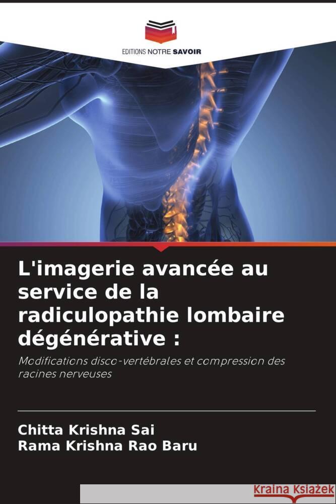 L'imagerie avancée au service de la radiculopathie lombaire dégénérative : Sai, Chitta Krishna, Baru, Rama Krishna Rao 9786208657352