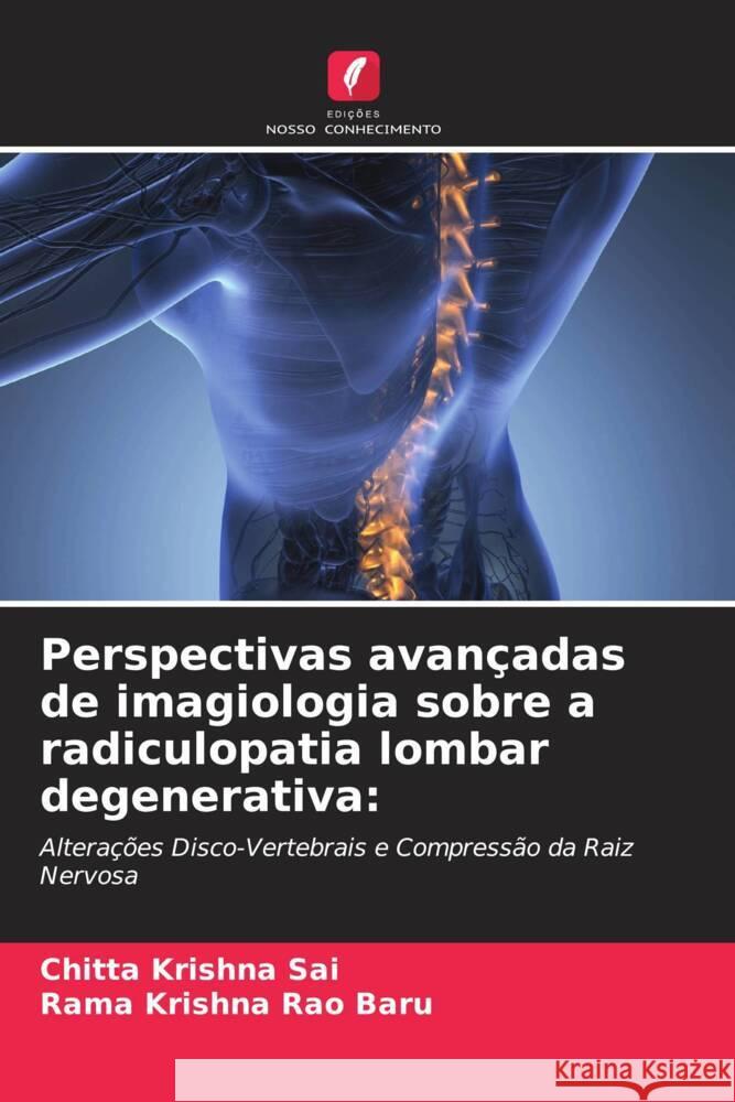 Perspectivas avançadas de imagiologia sobre a radiculopatia lombar degenerativa: Sai, Chitta Krishna, Baru, Rama Krishna Rao 9786208657376