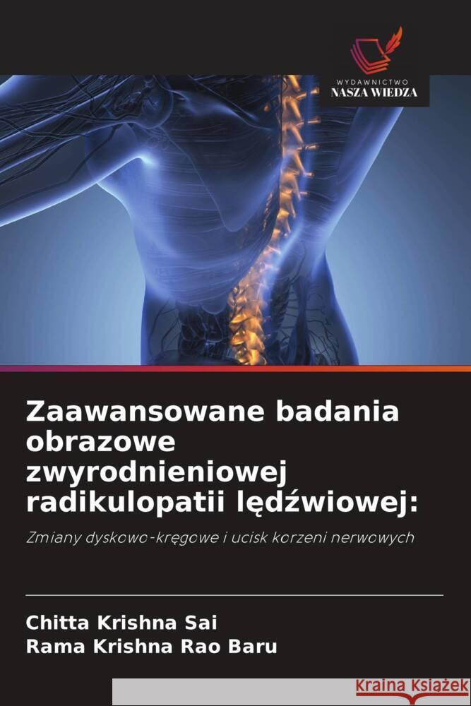 Zaawansowane badania obrazowe zwyrodnieniowej radikulopatii ledzwiowej: Sai, Chitta Krishna, Baru, Rama Krishna Rao 9786208657383