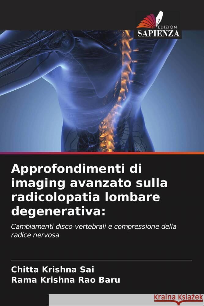 Approfondimenti di imaging avanzato sulla radicolopatia lombare degenerativa: Sai, Chitta Krishna, Baru, Rama Krishna Rao 9786208657390