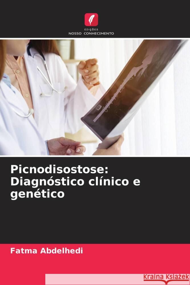 Picnodisostose: Diagnóstico clínico e genético Abdelhedi, Fatma 9786208660505