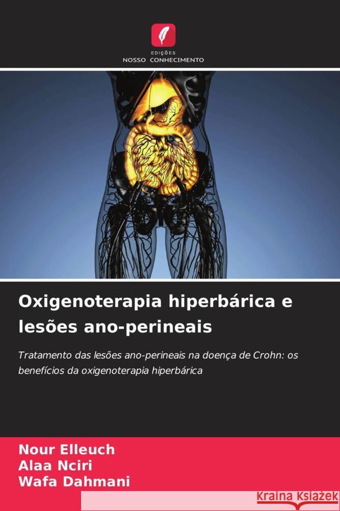 Oxigenoterapia hiperbárica e lesões ano-perineais Elleuch, Nour, Nciri, Alaa, Dahmani, Wafa 9786208660758