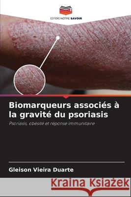 Biomarqueurs associés à la gravité du psoriasis Vieira Duarte, Gleison 9786208668303