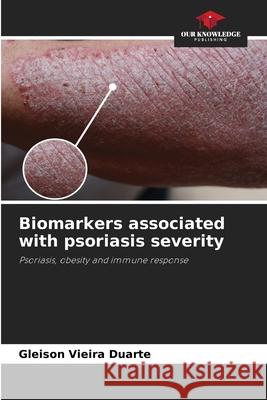 Biomarkers associated with psoriasis severity Vieira Duarte, Gleison 9786208668334
