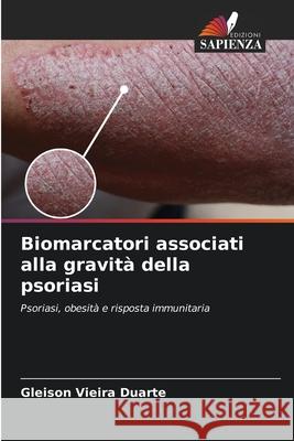 Biomarcatori associati alla gravità della psoriasi Vieira Duarte, Gleison 9786208668341