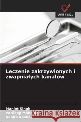 Leczenie zakrzywionych i zwapnialych kanalów Singh, Manjot, Mahajan, Pardeep, Keshav, Vanita 9786208671549