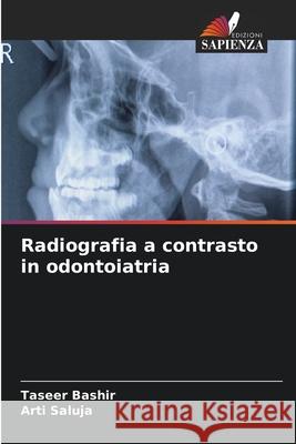 Radiografia a contrasto in odontoiatria Bashir, Taseer, Saluja, Arti 9786208683634