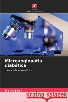 Microangiopatia diabética Shahi, Mohit 9786208686888 Edições Nosso Conhecimento