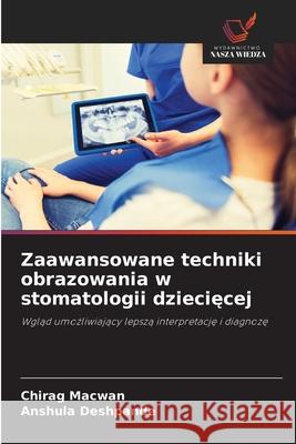 Zaawansowane techniki obrazowania w stomatologii dzieciecej Macwan, Chirag, Deshpande, Anshula 9786208694517