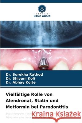 Vielfältige Rolle von Alendronat, Statin und Metformin bei Parodontitis Rathod, Dr. Surekha, Koli, Dr. Shivani, Kolte, Dr. Abhay 9786208695903