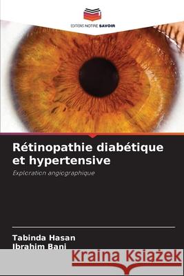 Rétinopathie diabétique et hypertensive Hasan, Tabinda, Bani, Ibrahim 9786208697907 Editions Notre Savoir