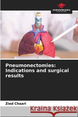 Pneumonectomies: Indications and surgical results Chaari, Zied 9786208700096
