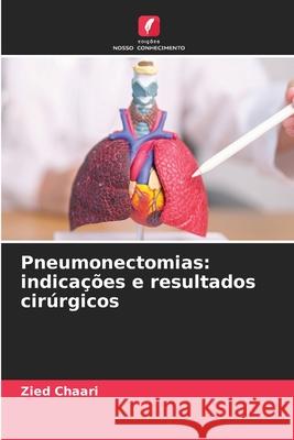 Pneumonectomias: indicações e resultados cirúrgicos Chaari, Zied 9786208700263
