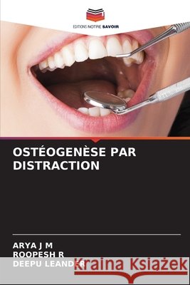 OSTÉOGENÈSE PAR DISTRACTION J M, ARYA, R, ROOPESH, LEANDER, DEEPU 9786208701611 Editions Notre Savoir