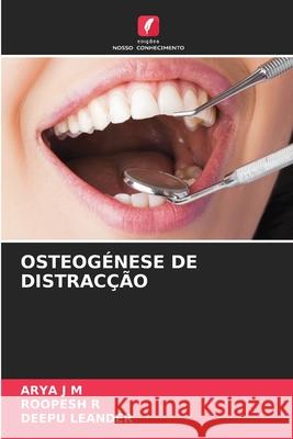 OSTEOGÉNESE DE DISTRACÇÃO J M, ARYA, R, ROOPESH, LEANDER, DEEPU 9786208701659 Edições Nosso Conhecimento