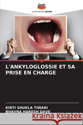 L'ANKYLOGLOSSIE ET SA PRISE EN CHARGE SHUKLA TIWARI, KIRTI, HARESH DAVE, BHAVNA 9786208710828