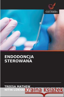 ENDODONCJA STEROWANA MATHEW, TREESA, Lokhande, Nitin 9786208711146
