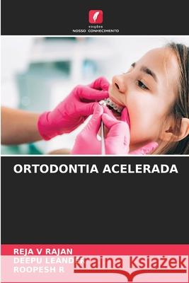 ORTODONTIA ACELERADA V RAJAN, REJA, LEANDER, DEEPU, R, ROOPESH 9786208714192 Edições Nosso Conhecimento