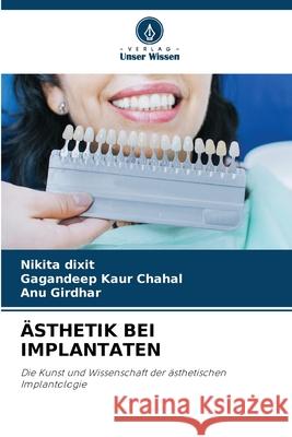 ÄSTHETIK BEI IMPLANTATEN Dixit, Nikita, Chahal, Gagandeep kaur, Girdhar, ANU 9786208715472