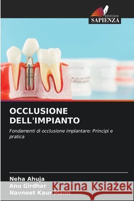 OCCLUSIONE DELL'IMPIANTO Ahuja, Neha, Girdhar, ANU, Kaur Mann, Navneet 9786208715755