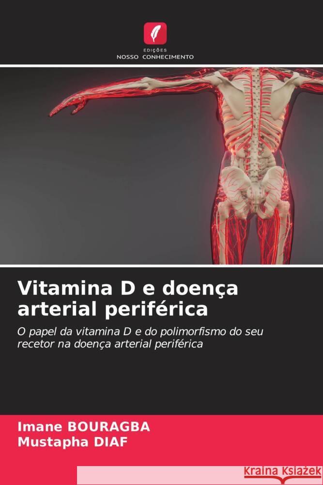 Vitamina D e doença arterial periférica BOURAGBA, Imane, Diaf, Mustapha 9786208716110