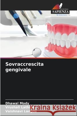 Sovraccrescita gengivale Mody, Dhawal, Lathiya, Vrushali, LANGDE, VAISHNAVI 9786208739584