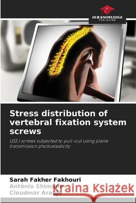 Stress distribution of vertebral fixation system screws Fakher Fakhouri, Sarah, Shimano, Antônio, Araújo, Cleudmar 9786208740900