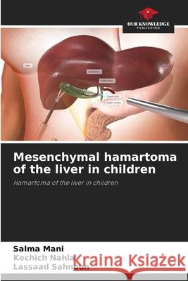 Mesenchymal hamartoma of the liver in children Mani, Salma, Nahla, Kechich, Sahnoun, Lassaad 9786208741334