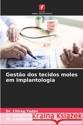 Gestão dos tecidos moles em Implantologia Yadav, Dr. Chirag, Agarwal, Dr. Garima, Bhaumik, Dr. Kaushitaki 9786208743390