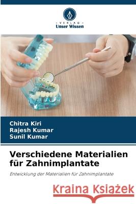 Verschiedene Materialien für Zahnimplantate Kiri, Chitra, Kumar, Rajesh, Kumar, Sunil 9786208750015 Verlag Unser Wissen