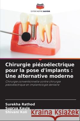 Chirurgie piézoélectrique pour la pose d'implants : Une alternative moderne Rathod, Surekha, Kaule, Suprya, KOLI, SHIVANI 9786208753511 Editions Notre Savoir