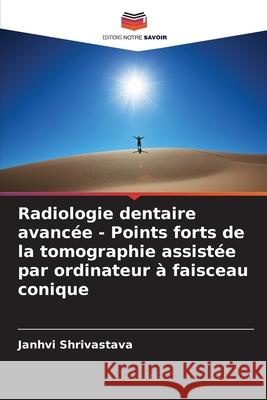 Radiologie dentaire avancée - Points forts de la tomographie assistée par ordinateur à faisceau conique Shrivastava, Janhvi 9786208754969 Editions Notre Savoir