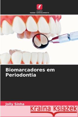 Biomarcadores em Periodontia Sinha, Jolly 9786208757748 Edições Nosso Conhecimento