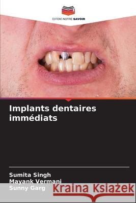 Implants dentaires immédiats Singh, Sumita, Vermani, Mayank, Garg, Sunny 9786208765125