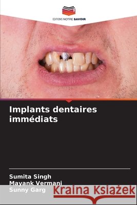 Implants dentaires immédiats Singh, Sumita, Vermani, Mayank, Garg, Sunny 9786208765125